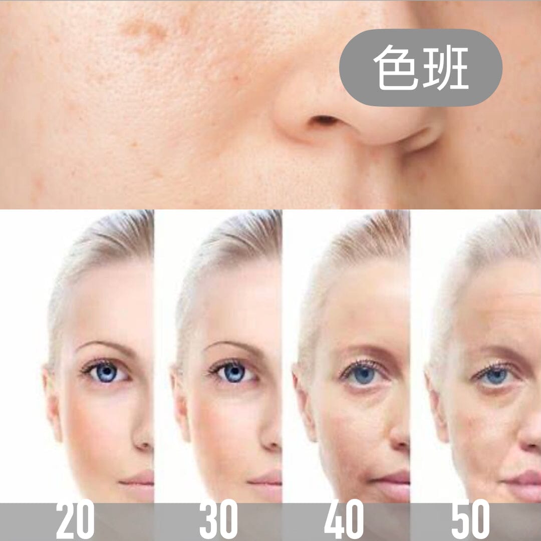 PAKA UV修護 {特效} 幫您減退色斑、修護細胞、抵抗光老化、減少⿊⾊素形成 ... 拯救【大小色斑】！ Beauty Health XTREME 